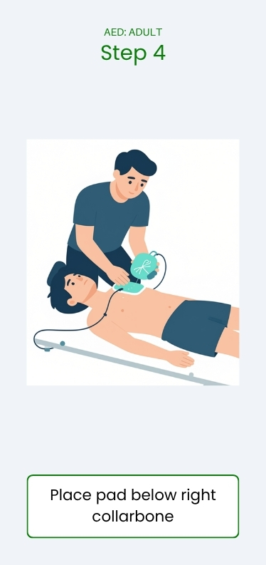 aed use pad placement