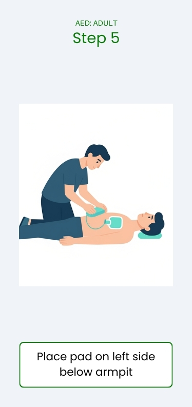 AED Use pad placement