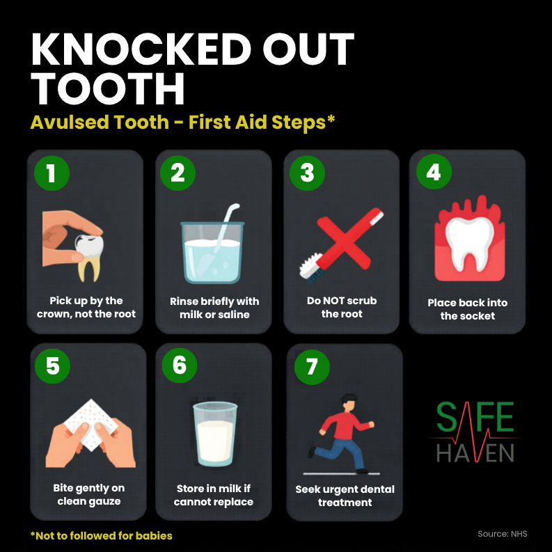 First Aid for Knocked Out Tooth 